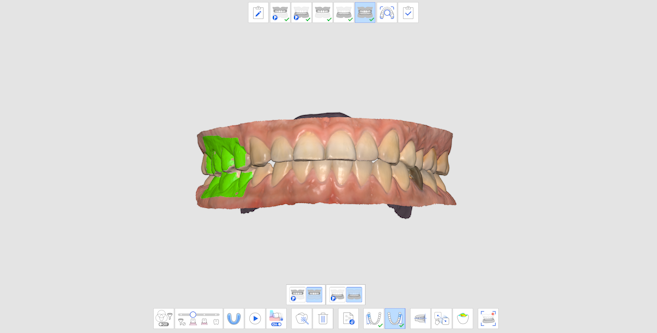 Imagen para escaner intraoral